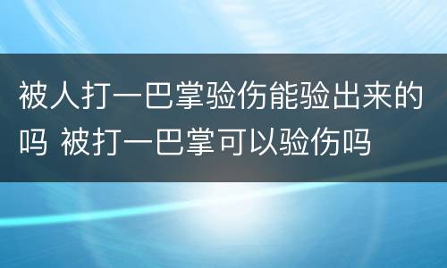被人打一巴掌验伤能验出来的吗 被打一巴掌可以验伤吗