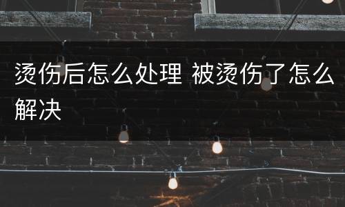 烫伤后怎么处理 被烫伤了怎么解决
