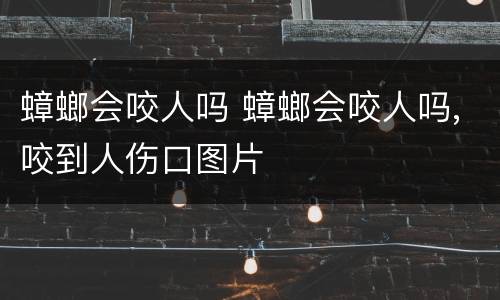 蟑螂会咬人吗 蟑螂会咬人吗,咬到人伤口图片